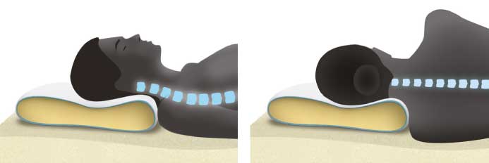 ANATÓMIAI PÁRNA NYAKFÁJÁSRA? ANATÓMIAI PÁRNA NYAKFÁJÁSRA?